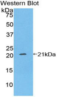 Pleckstrin Homology Like Domain Family A, Member 2 (PHLDA2) Polyclonal Antibody - image 3