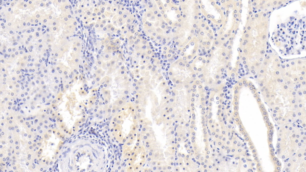 DAB staining on IHC-P; Sample: Human Cerebrum Tissue; Primary Ab: 30ug/ml Mouse Anti-Human NRGN Antibody; Control: Used PBS instead of primary antibody; Second Ab: 2ug/ml HRP-Linked Caprine Anti-Mouse IgG Polyclonal Antibody