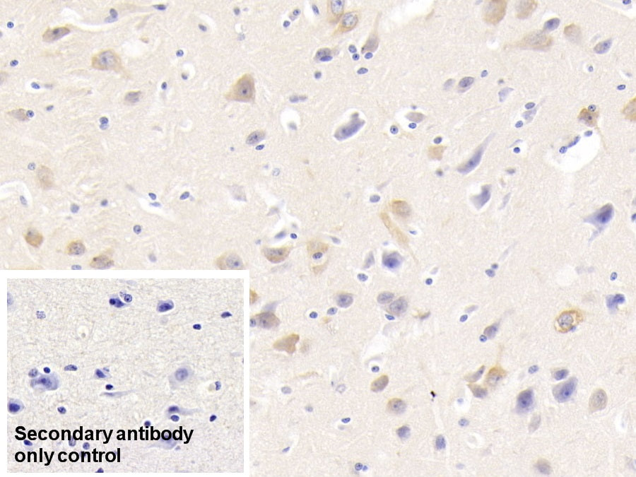 DAB staining on IHC-P; Sample: Human Kidney Tissue; Primary Ab: 30ug/ml Mouse Anti-Human NRGN Antibody; Control: Used PBS instead of primary antibody; Second Ab: 2ug/ml HRP-Linked Caprine Anti-Mouse IgG Polyclonal Antibody