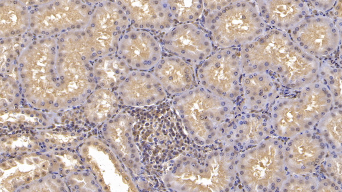 DAB staining on IHC-P; Sample: Human Liver Tissue; Primary Ab: 10ug/ml Mouse Anti-Human ANXA3 Antibody; Second Ab: 2ug/mL HRP-Linked Caprine Anti-Mouse IgG Polyclonal Antibody