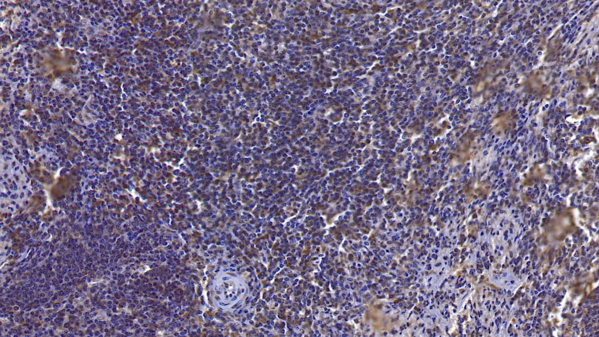 Western Blot; Sample: Lane1: Human Lung lysate; Lane2: A549 cell lysate Primary Ab: 0.1ug/ml Mouse Anti-Human ANXA3 Antibody Second Ab: 0.2ug/mL HRP-Linked Caprine Anti-Mouse IgG Polyclonal Antibody