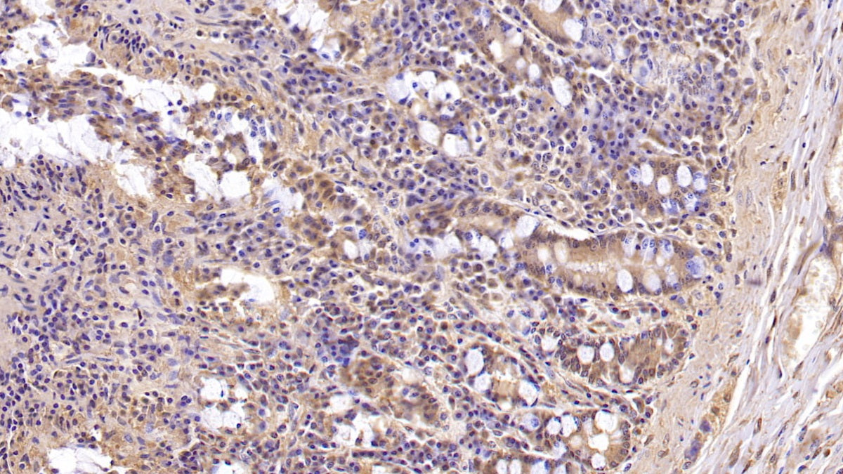 Mucin 5 Subtype B (MUC5B) Monoclonal Antibody - image 2