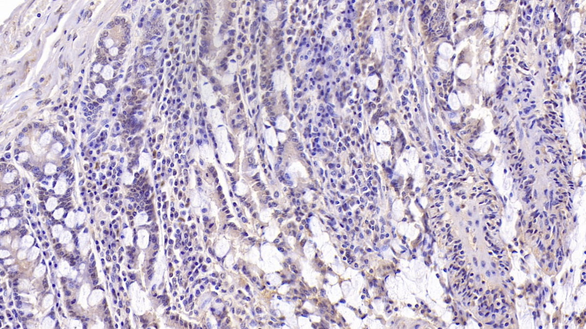 Mucin 5 Subtype B (MUC5B) Monoclonal Antibody - image 2
