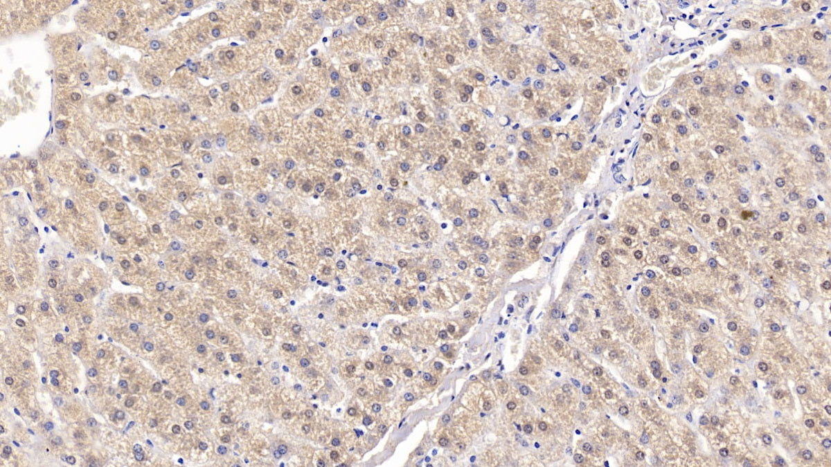 DAB staining on IHC-P; Sample: Human Colon Tissue; Primary Ab: 20ug/ml Mouse Anti-Human Visfatin Antibody; Second Ab: 2ug/mL HRP-Linked Caprine Anti-Mouse IgG Polyclonal Antibody