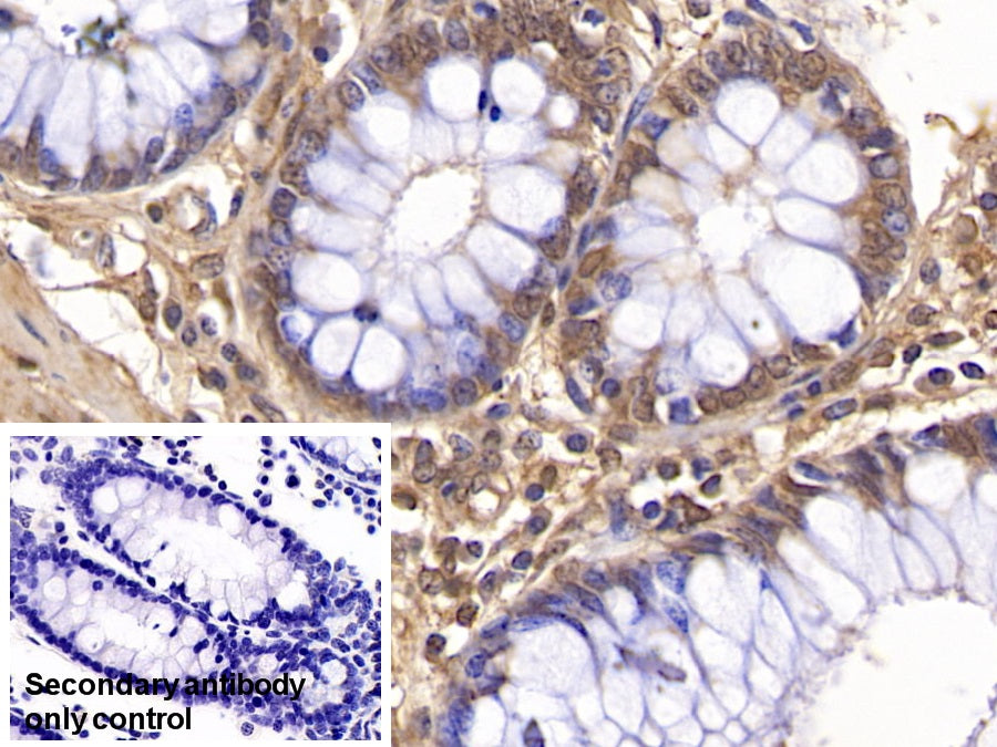 DAB staining on IHC-P; Sample: Human Liver Tissue; Primary Ab: 20ug/ml Mouse Anti-Human VF Antibody; Control: Used PBS instead of primary antibody; Second Ab: 2ug/ml HRP-Linked Caprine Anti-Mouse IgG Polyclonal Antibody
