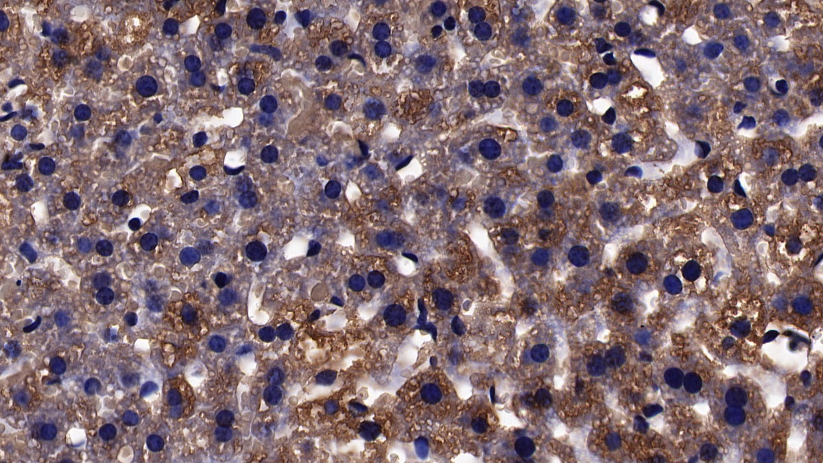 DAB staining on IHC-P; Sample: Mouse Cardiac Muscle Tissue; Primary Ab: 10ug/ml Rabbit Anti-Mouse ACSL1 Antibody; Second Ab: 2ug/mL HRP-Linked Caprine Anti-Rabbit IgG Polyclonal Antibody