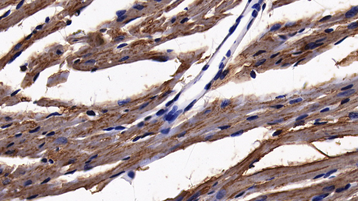 DAB staining on IHC-P; Sample: Mouse Kidney Tissue; Primary Ab: 10ug/ml Rabbit Anti-Mouse ACSL1 Antibody; Second Ab: 2ug/mL HRP-Linked Caprine Anti-Rabbit IgG Polyclonal Antibody