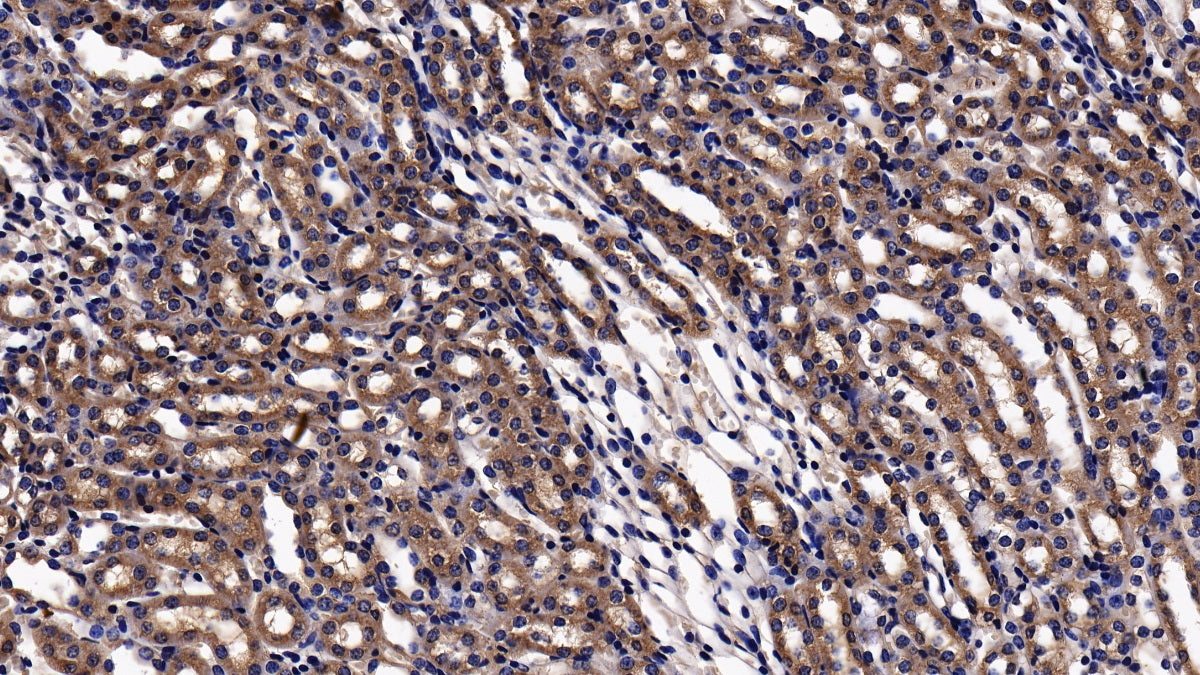 Western Blot; Sample: Lane1: Mouse Liver lysate; Lane2: Rat Liver lysate Primary Ab: 0.2ug/ml Rabbit Anti-Mouse ACSL1 Antibody Second Ab: 0.2ug/mL HRP-Linked Caprine Anti-Rabbit IgG Polyclonal Antibody