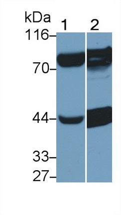 Acyl Coenzyme A Synthetase Long Chain Family, Member 1 (ACSL1) Polyclonal Antibody - image 5