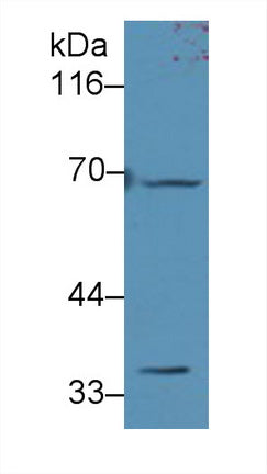 Adenine Phosphoribosyltransferase (APRT) Polyclonal Antibody - image 3