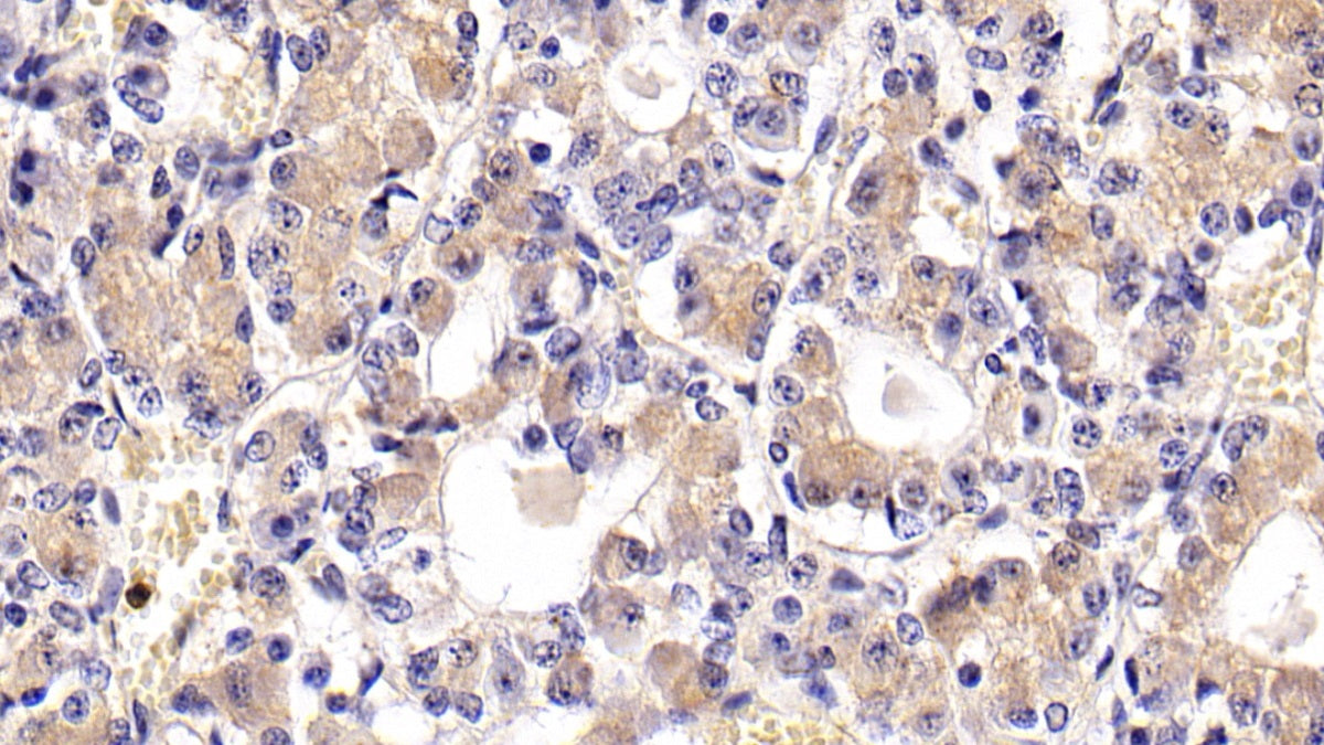 DAB staining on IHC-P; Sample: Porcine Pituitary Tissue; Primary Ab: 20ug/ml Mouse Anti-Rat FSHb Antibody; Control: Used PBS instead of primary antibody; Second Ab: 2ug/ml HRP-Linked Caprine Anti-Mouse IgG Polyclonal Antibody