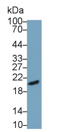 Follicle Stimulating Hormone Beta (FSHb) Monoclonal Antibody - image 4