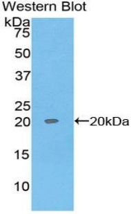Regenerating Islet Derived Protein 1 Alpha (REG1a) Monoclonal Antibody - image 2