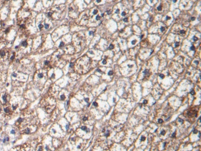 Transforming Growth Factor Beta 1 (TGFb1) Monoclonal Antibody - image 2