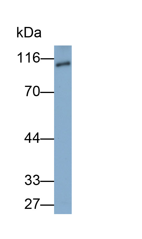 Androgen Receptor (AR) Polyclonal Antibody - image 3