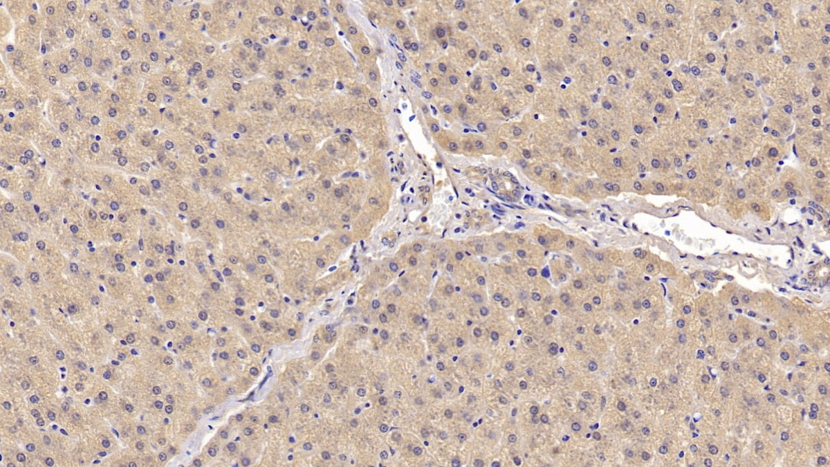 DAB staining on IHC-P; Sample: Human Kidney Tissue; Primary Ab: 20ug/ml Mouse Anti-Human ACVR2A Antibody; Second Ab: 2ug/mL HRP-Linked Caprine Anti-Mouse IgG Polyclonal Antibody