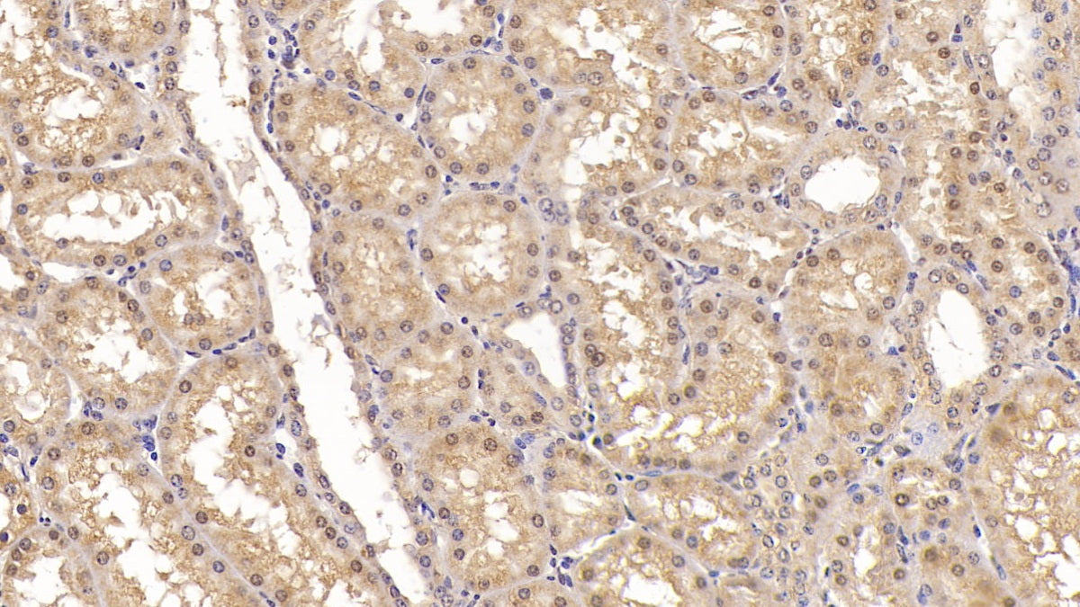 DAB staining on IHC-P; Sample: Human Spleen Tissue; Primary Ab: 20ug/ml Mouse Anti-Human ACVR2A Antibody; Second Ab: 2ug/mL HRP-Linked Caprine Anti-Mouse IgG Polyclonal Antibody