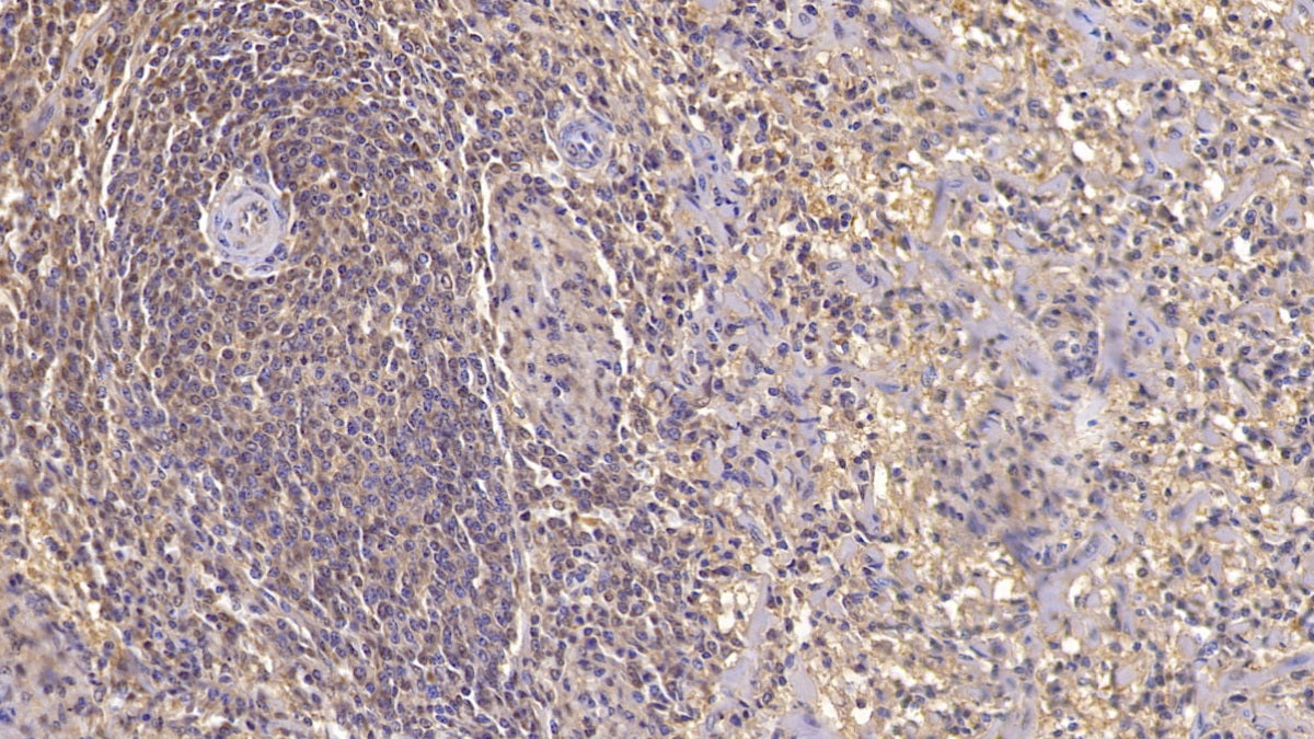 DAB staining on IHC-P; Sample: Human Cardiac Muscle Tissue; Primary Ab: 20ug/ml Mouse Anti-Human ACVR2A Antibody; Second Ab: 2ug/mL HRP-Linked Caprine Anti-Mouse IgG Polyclonal Antibody