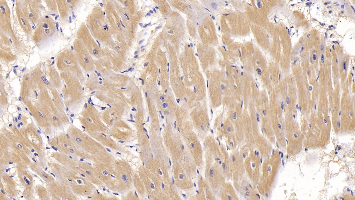 Activin A Receptor Type II A (ACVR2A) Monoclonal Antibody - image 5