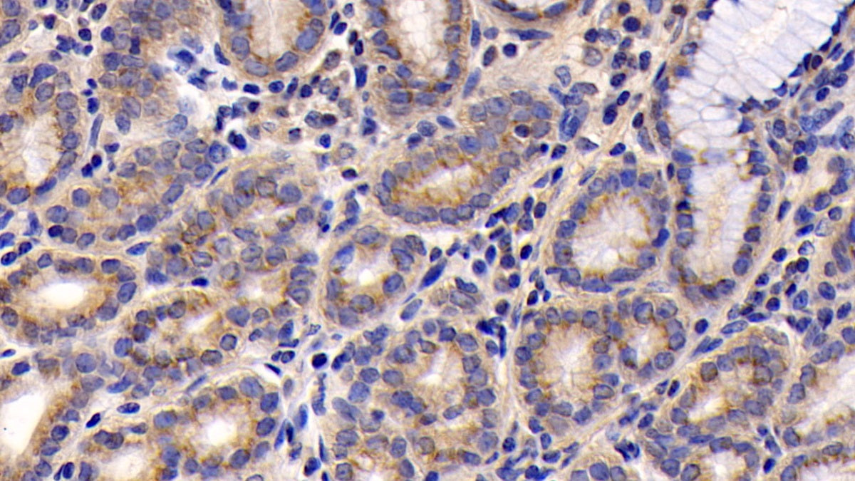 DAB staining on IHC-P; Sample: Human Lymph node Tissue; Primary Ab: 30ug/ml Mouse Anti-Human CXCL16 Antibody; Second Ab: 2ug/mL HRP-Linked Caprine Anti-Mouse IgG Polyclonal Antibody