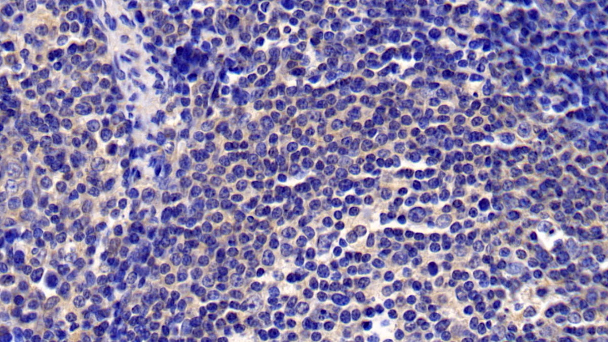 DAB staining on IHC-P; Sample: Human Spleen Tissue; Primary Ab: 30ug/ml Mouse Anti-Human CXCL16 Antibody; Second Ab: 2ug/mL HRP-Linked Caprine Anti-Mouse IgG Polyclonal Antibody