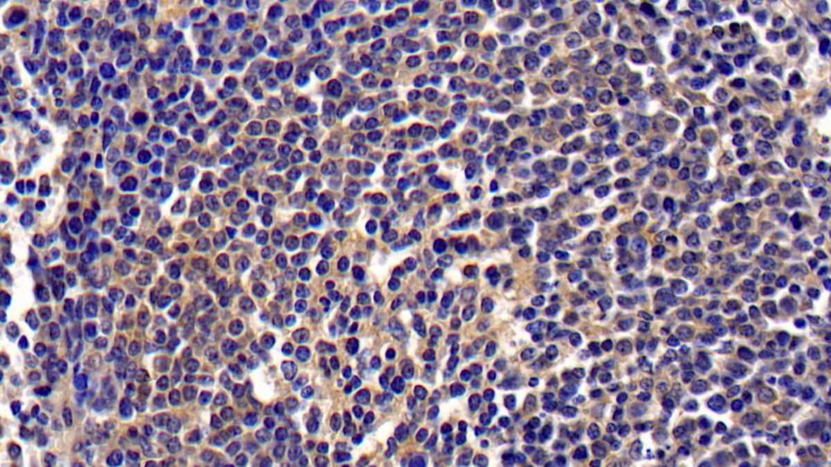 Chemokine C-X-C-Motif Ligand 16 (CXCL16) Monoclonal Antibody - image 4