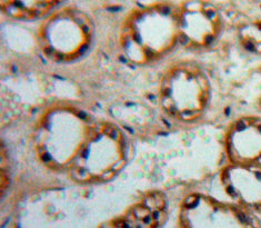 Western Blot; Sample: Recombinant ADCY1, Human.