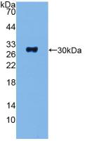 Adenylate Cyclase 1, Brain (ADCY1) Polyclonal Antibody - image 3