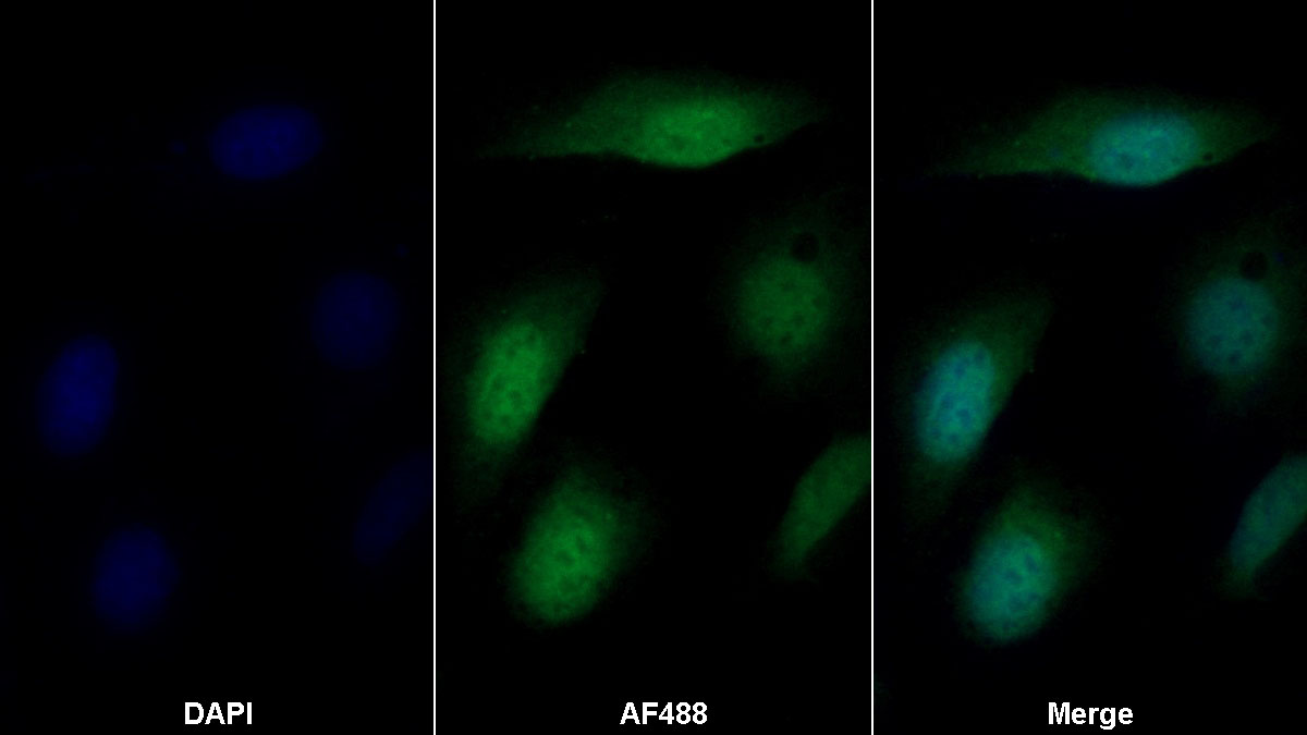 Western Blot; Samples: Lane1: Human Placenta lysate; Lane2: Porcine Stomach lysate; Primary Ab: 0.4ug/ml Mouse Anti-Human AMOT Antibody; Second Ab: 0.2ug/ml HRP-Linked Caprine Anti-Mouse IgG Polyclonal Antibody