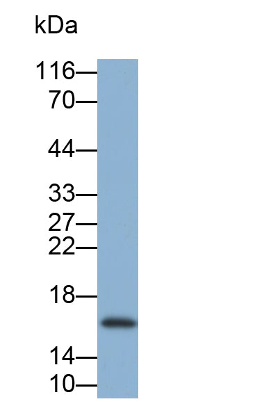 Cystatin 1 (CST1) Monoclonal Antibody - image 2