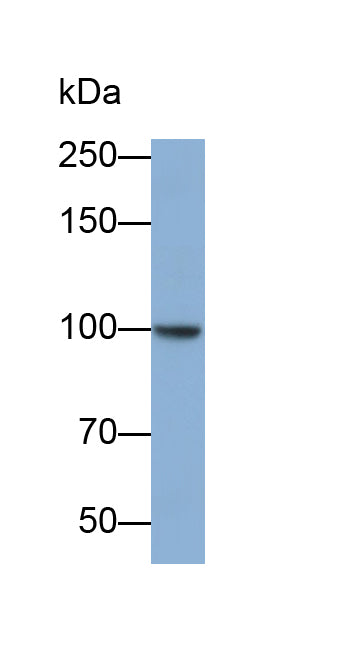 Adenosine Deaminase, RNA Specific (ADAR) Polyclonal Antibody - image 2