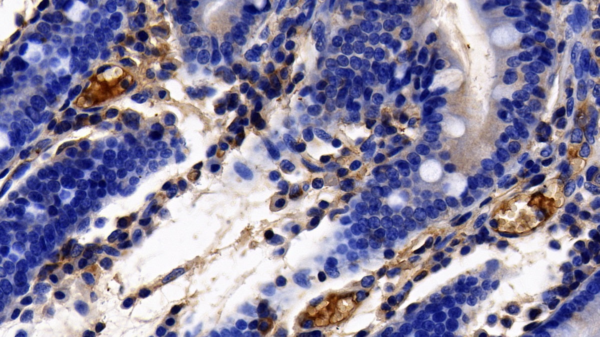 DAB staining on IHC-P; Sample: Porcine Cerebrum Tissue; Primary Ab: 10ug/ml Rabbit Anti-Porcine aHSG Antibody; Second Ab: 2ug/mL HRP-Linked Caprine Anti-Rabbit IgG Polyclonal Antibody
