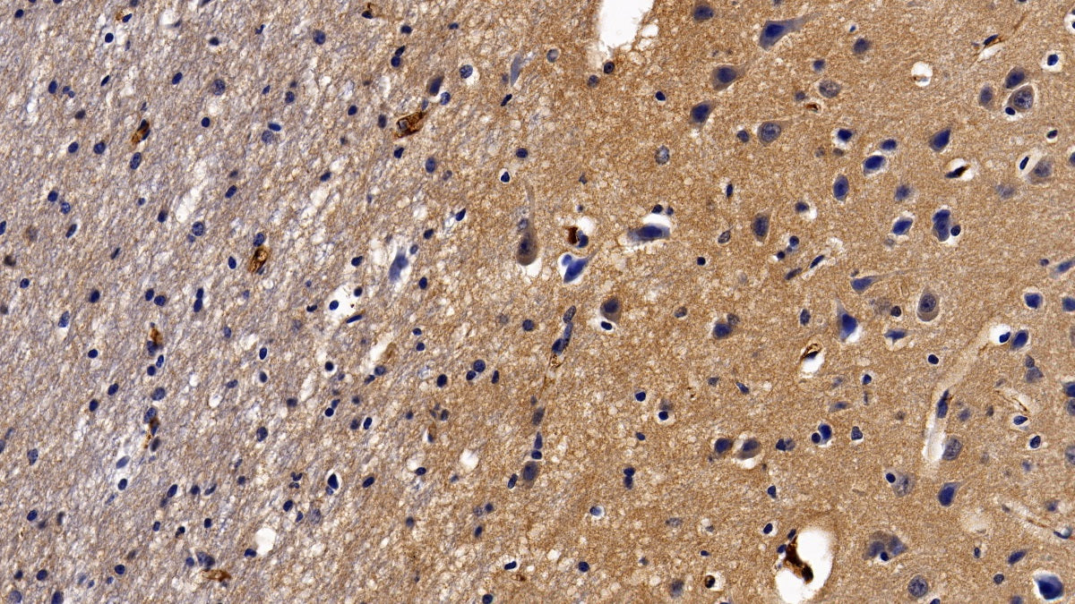 DAB staining on IHC-P; Sample: Porcine Lung Tissue; Primary Ab: 10ug/ml Rabbit Anti-Porcine aHSG Antibody; Second Ab: 2ug/mL HRP-Linked Caprine Anti-Rabbit IgG Polyclonal Antibody