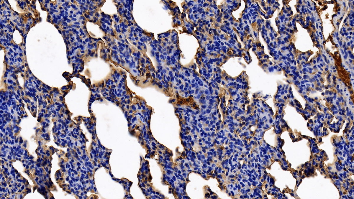 DAB staining on IHC-P; Sample: Porcine Small intestine Tissue; Primary Ab: 10ug/ml Rabbit Anti-Porcine aHSG Antibody; Control: Used PBS instead of primary antibody; Second Ab: 2ug/ml HRP-Linked Caprine Anti-Rabbit IgG Polyclonal Antibody