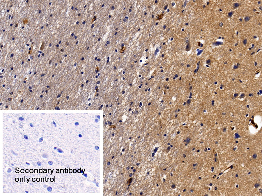 Alpha-2-Heremans Schmid Glycoprotein (AHSG) Polyclonal Antibody - image 5