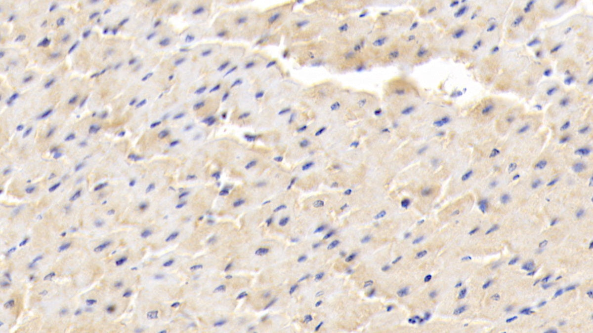 DAB staining on IHC-P; Sample: Human Kidney Tissue; Primary Ab: 20ug/ml Mouse Anti-Human ADP Antibody; Second Ab: 2ug/mL HRP-Linked Caprine Anti-Mouse IgG Polyclonal Antibody