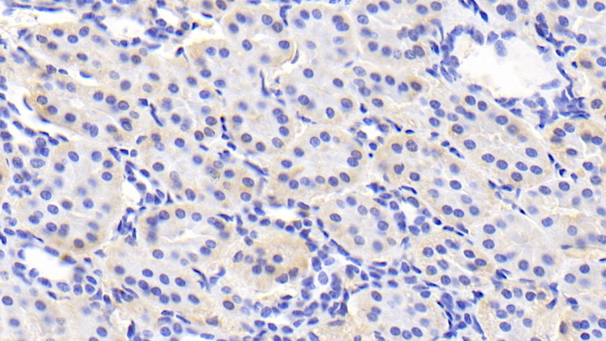 DAB staining on IHC-P; Sample: Human Cardiac Muscle Tissue; Primary Ab: 20ug/ml Mouse Anti-Human ADPN Antibody; Control: Used PBS instead of primary antibody; Second Ab: 2ug/ml HRP-Linked Caprine Anti-Mouse IgG Polyclonal Antibody
