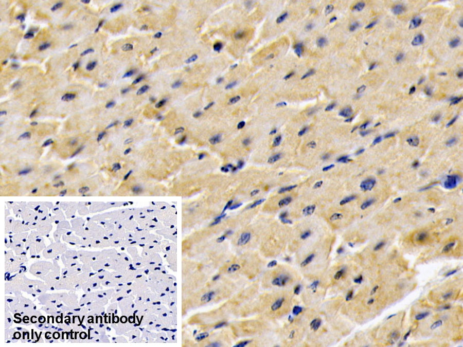 DAB staining on IHC-P; Sample: Human Kidney Tissue; Primary Ab: 20ug/ml Mouse Anti-Human ADPN Antibody; Control: Used PBS instead of primary antibody; Second Ab: 2ug/ml HRP-Linked Caprine Anti-Mouse IgG Polyclonal Antibody