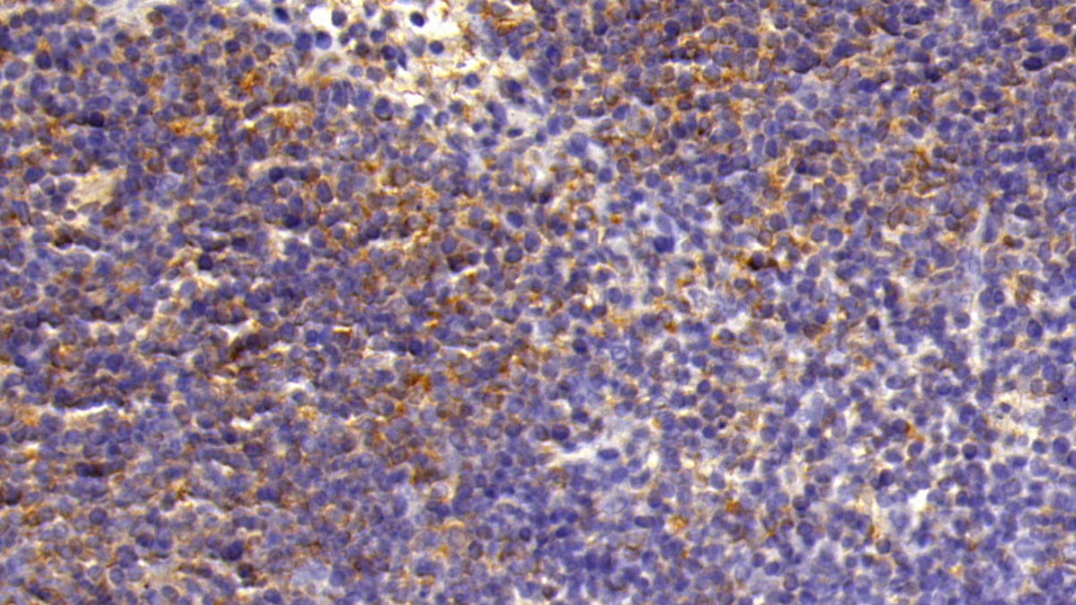 DAB staining on IHC-P; Sample: Rat Liver Tissue; Primary Ab: 10ug/ml Rabbit Anti-Rat CXCR3 Antibody; Second Ab: 2ug/mL HRP-Linked Caprine Anti-Rabbit IgG Polyclonal Antibody