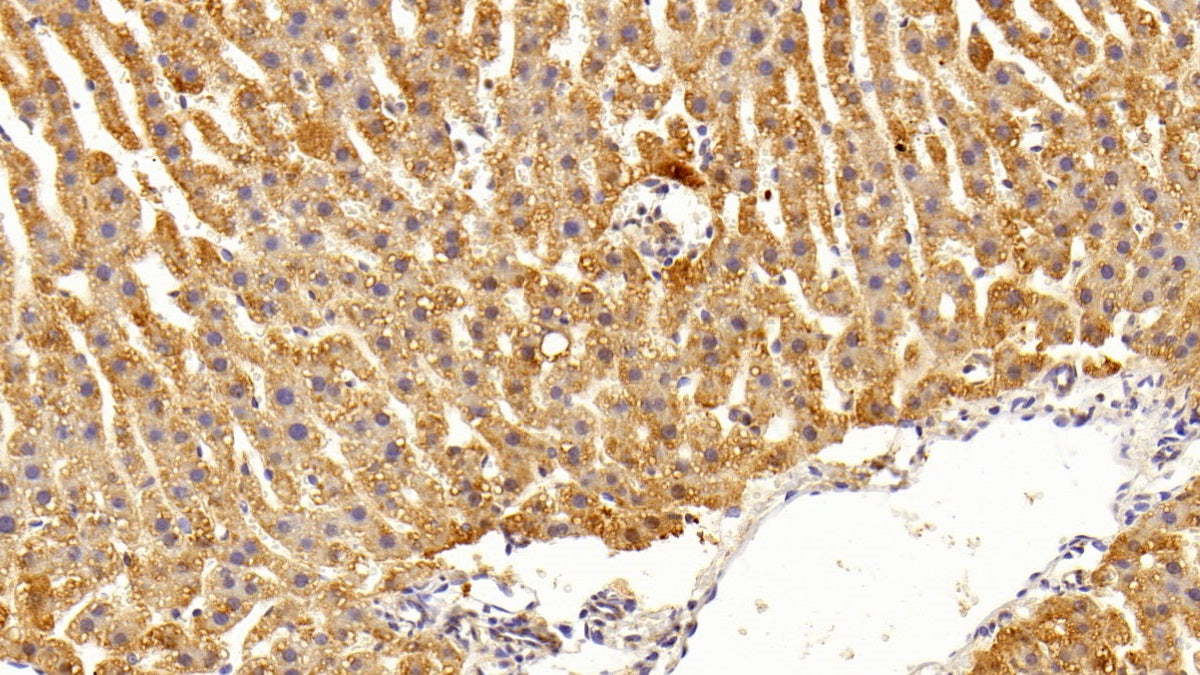 DAB staining on IHC-P; Sample: Rat Cerebrum Tissue; Primary Ab: 10ug/ml Rabbit Anti-Rat CXCR3 Antibody; Second Ab: 2ug/mL HRP-Linked Caprine Anti-Rabbit IgG Polyclonal Antibody