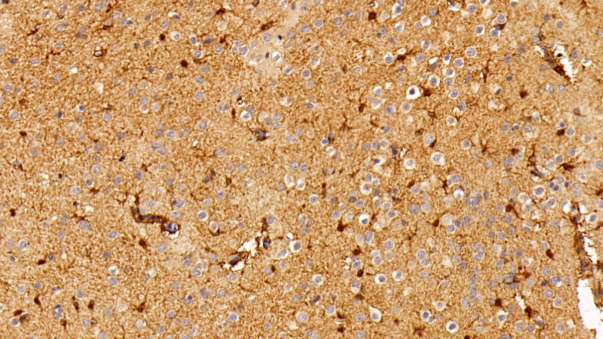 DAB staining on IHC-P; Sample: Rat Spleen Tissue; Primary Ab: 10ug/ml Rabbit Anti-Rat CXCR3 Antibody; Second Ab: 2ug/mL HRP-Linked Caprine Anti-Rabbit IgG Polyclonal Antibody