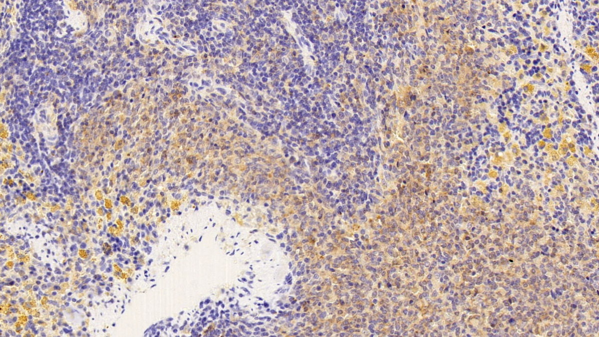 Chemokine C-X-C-Motif Receptor 3 (CXCR3) Polyclonal Antibody - image 5