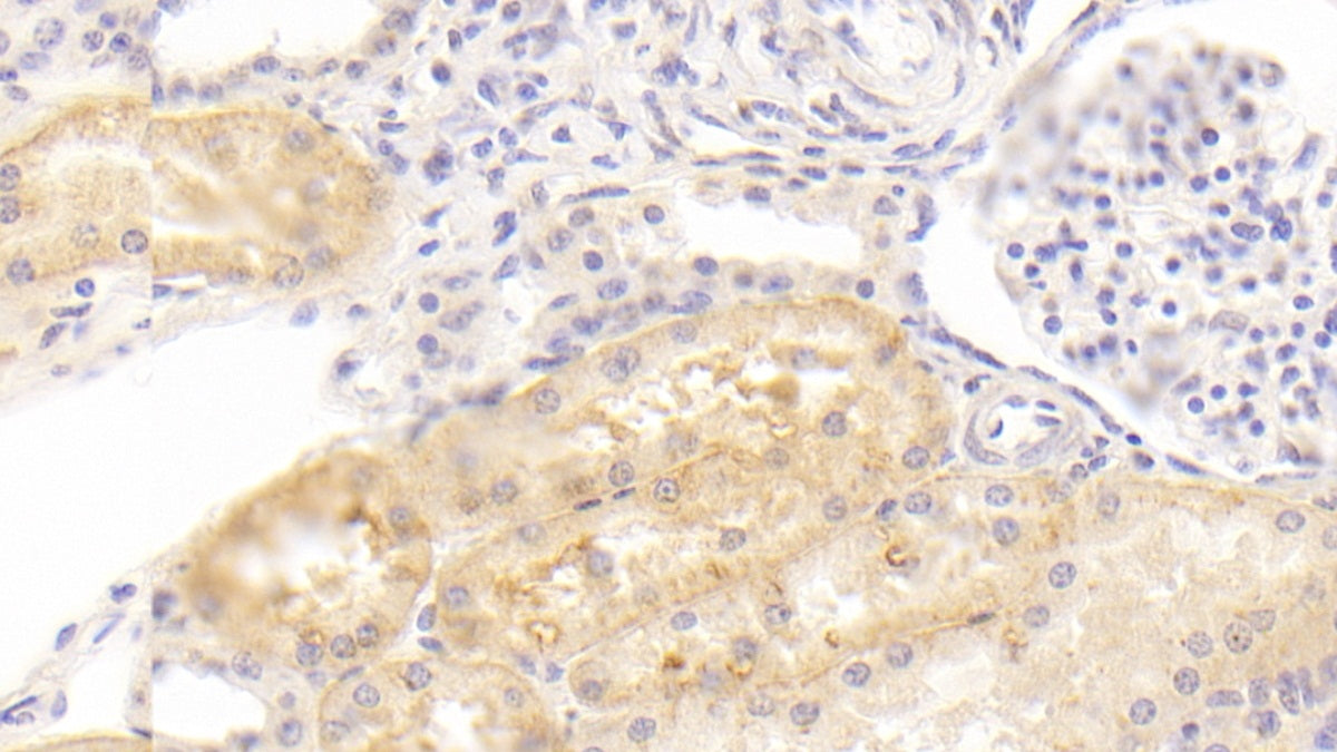 DAB staining on IHC-P; Sample: Porcine Kidney Tissue; Primary Ab: 20ug/ml Mouse Anti-Human ABP1 Antibody; Control: Used PBS instead of primary antibody; Second Ab: 2ug/ml HRP-Linked Caprine Anti-Mouse IgG Polyclonal Antibody
