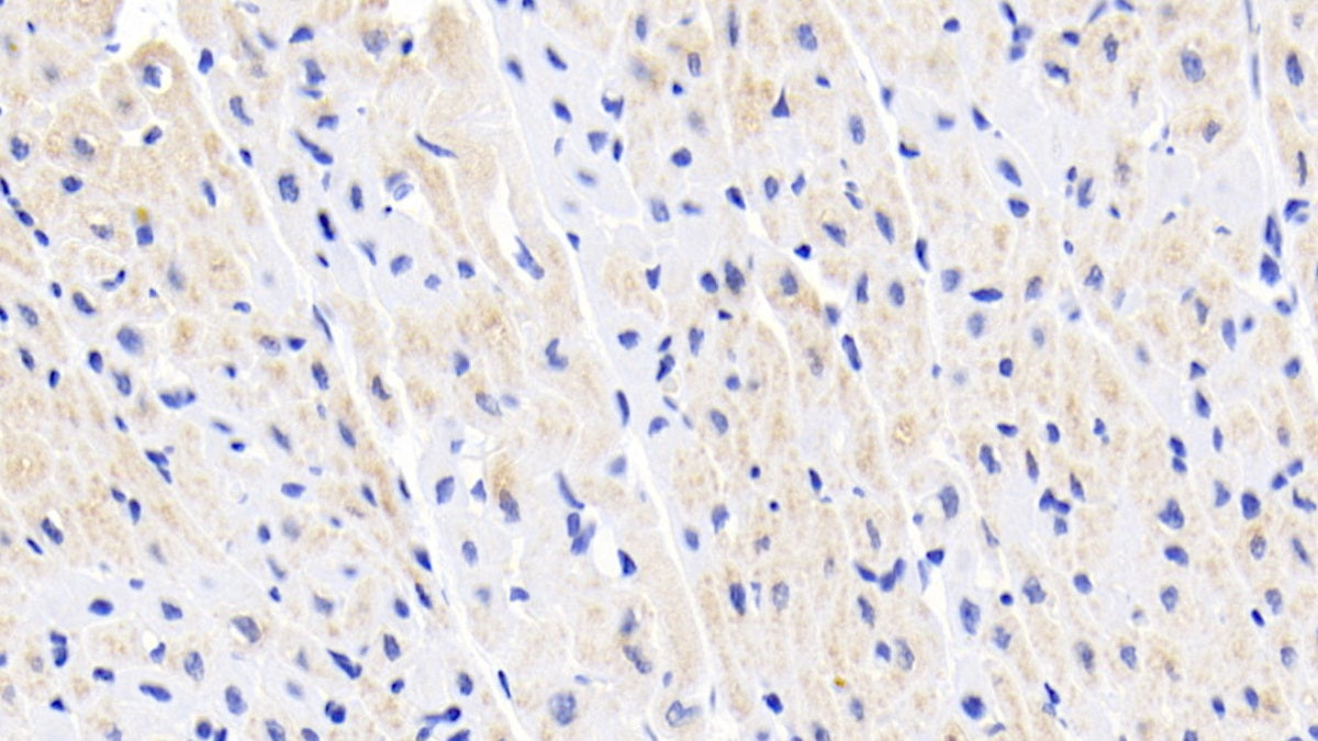 DAB staining on IHC-P; Sample: Human Stomach Tissue; Primary Ab: 20ug/ml Mouse Anti-Human CK-BB Antibody; Second Ab: 2ug/mL HRP-Linked Caprine Anti-Mouse IgG Polyclonal Antibody