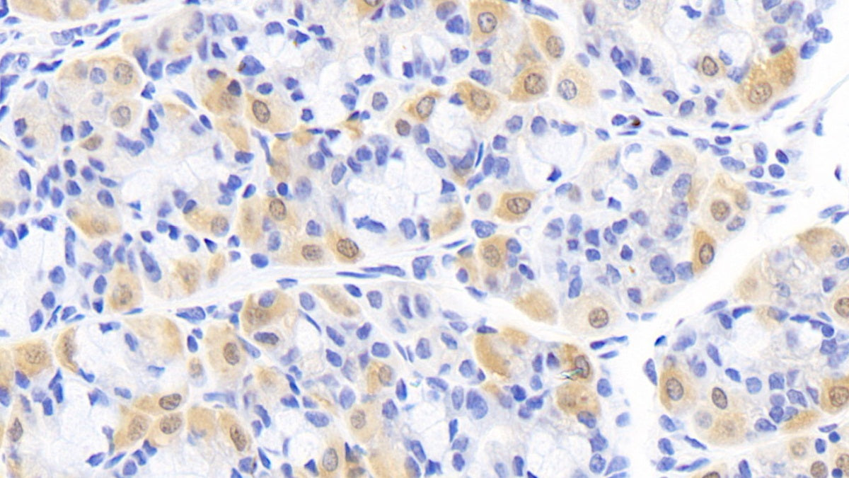 DAB staining on IHC-P; Sample: Human Cerebrum Tissue; Primary Ab: 20ug/ml Mouse Anti-Human CK-BB Antibody; Second Ab: 2ug/mL HRP-Linked Caprine Anti-Mouse IgG Polyclonal Antibody