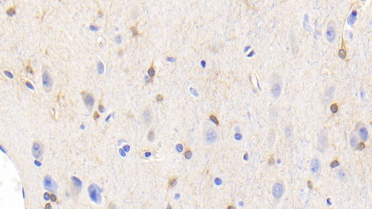 DAB staining on IHC-P; Sample: Human Cerebrum Tissue; Primary Ab: 20ug/ml Mouse Anti-Human CK-BB Antibody; Control: Used PBS instead of primary antibody; Second Ab: 2ug/ml HRP-Linked Caprine Anti-Mouse IgG Polyclonal Antibody