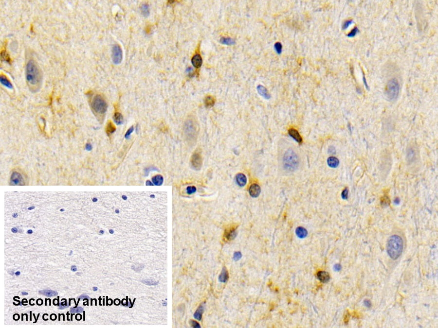 Creatine Kinase B (CK-BB) Monoclonal Antibody - image 5