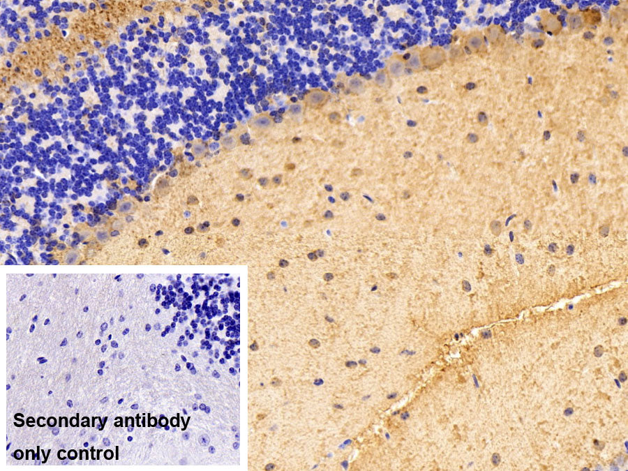 DAB staining on IHC-P; Sample: Mouse Spinal cord Tissue; Primary Ab: 10ug/ml Rabbit Anti-Human PVALB Antibody; Control: Used PBS instead of primary antibody; Second Ab: 2ug/ml HRP-Linked Caprine Anti-Rabbit IgG Polyclonal Antibody