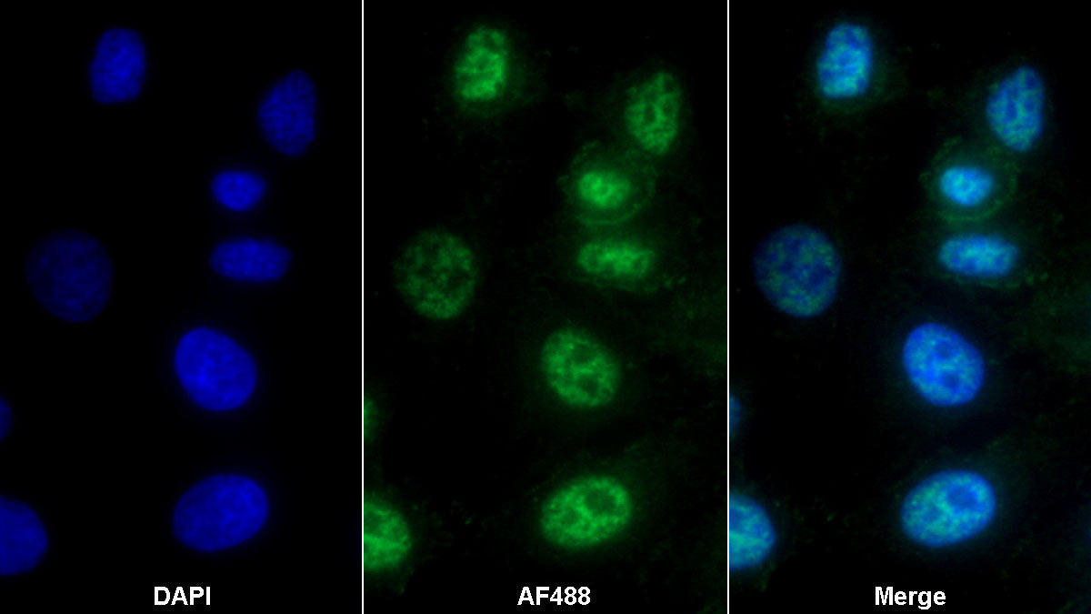 Western Blot; Samples: Lane1: Mouse Skeletal muscle lysate; Lane2: Rat Skeletal muscle lysate; Primary Ab: 0.1ug/ml Rabbit Anti-Human PVALB Antibody; Second Ab: 0.2ug/ml HRP-Linked Caprine Anti-Rabbit IgG Polyclonal Antibody