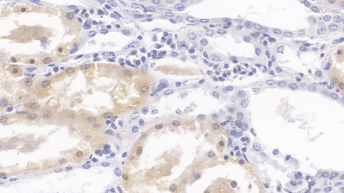 DAB staining on IHC-P; Samples: Human Liver Tissue; Primary Ab: 30ug/ml Mouse Anti-Human HPD Antibody; Second Ab: 2ug/mL HRP-Linked Caprine Anti-Mouse IgG Polyclonal Antibody